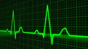 pulse trace, healthcare medicine, heartbeat